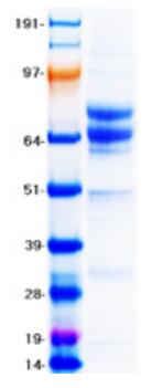 Coomassie blue staining of purified CD19 protein.